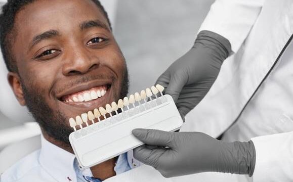 Veneers
